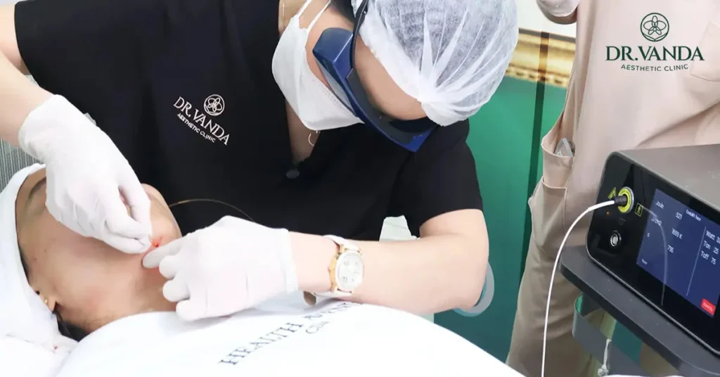 รีวิว EndoliftX หมอแวนด้า Laser Fiber vs. Light Scan ต่างกันยังไง