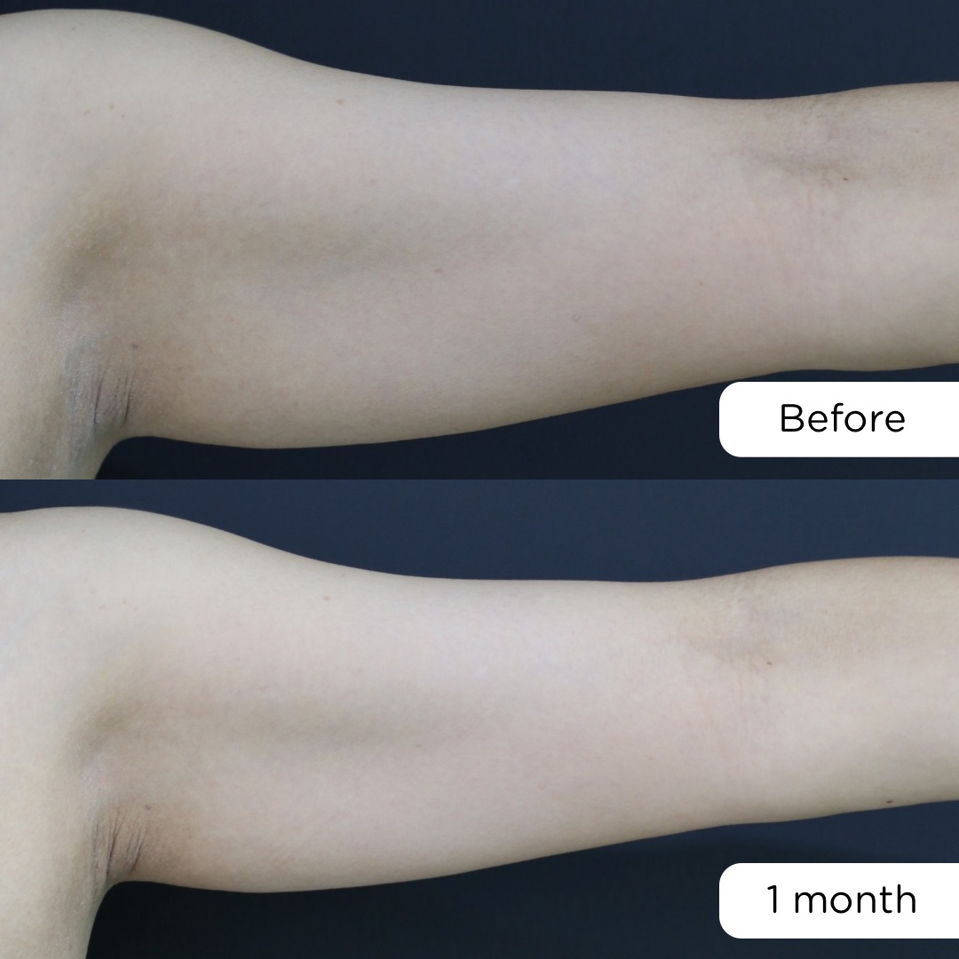 ก่อน-หลัง จัสตุรัส – 1