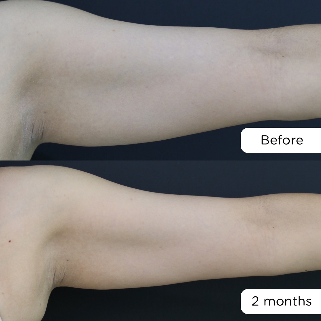 ก่อน-หลัง จัสตุรัส - 2