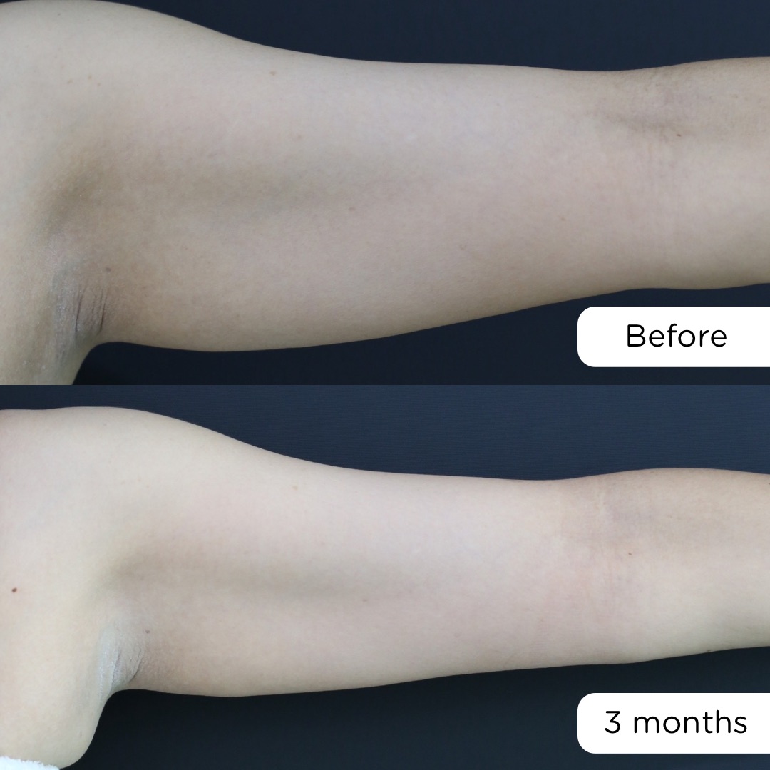 ก่อน-หลัง จัสตุรัส - 3